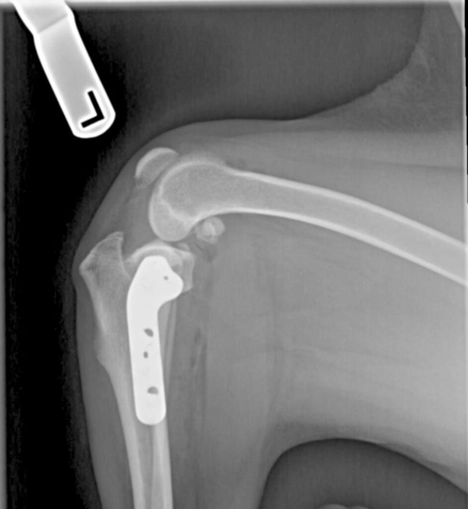 TPLO surgery for cruciate ligament injury - Lenity